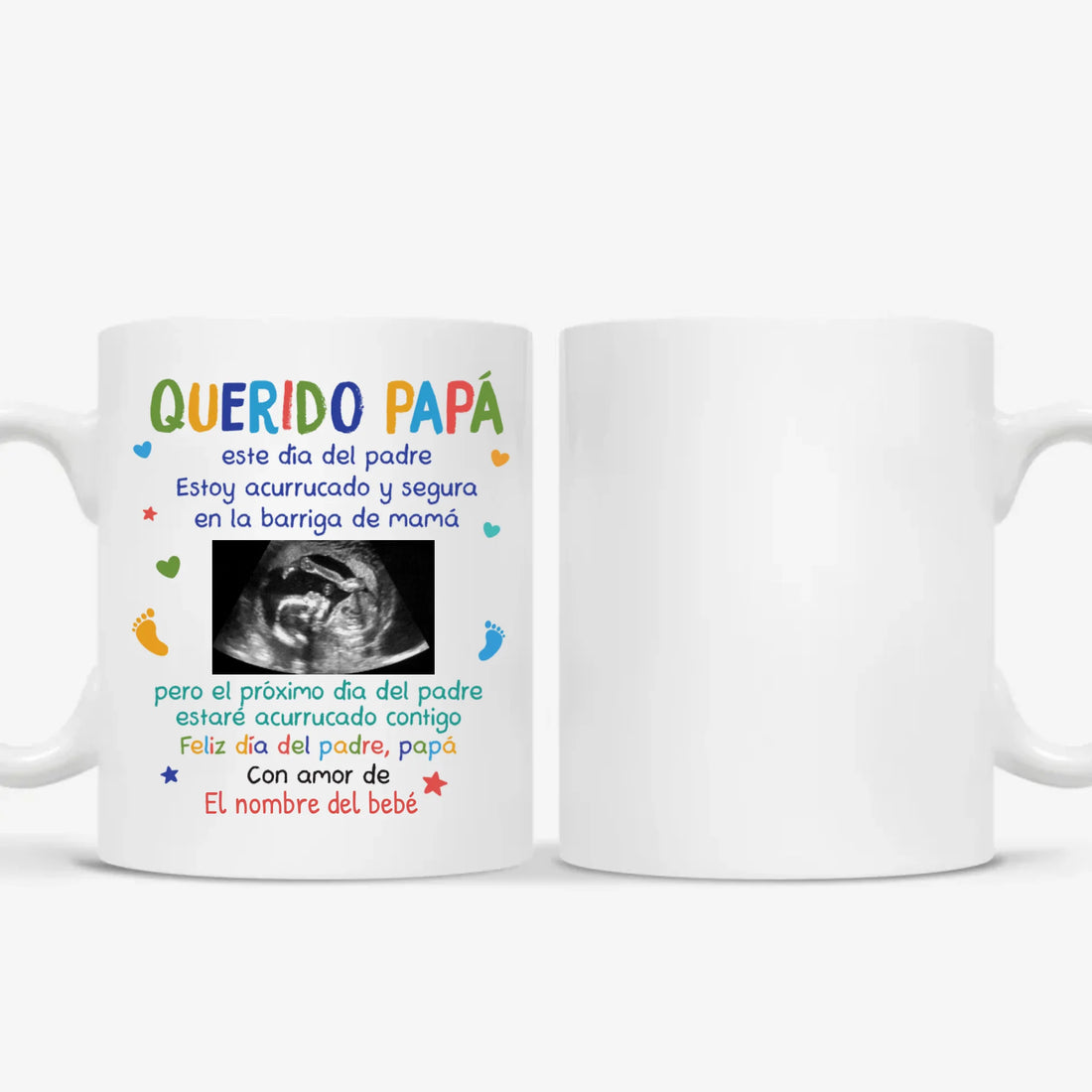 MUG Xám 2