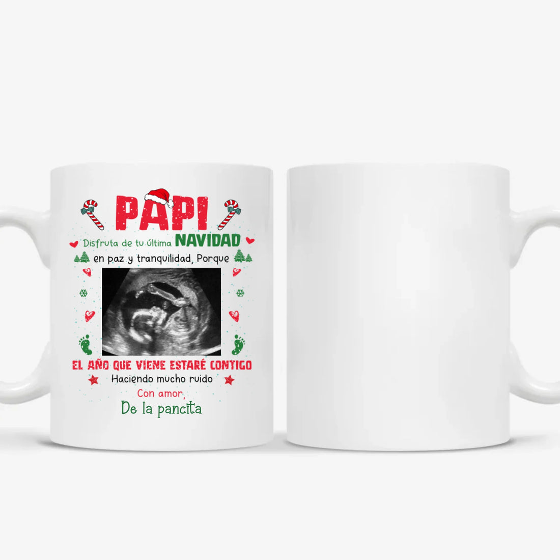 MUG Xám 2