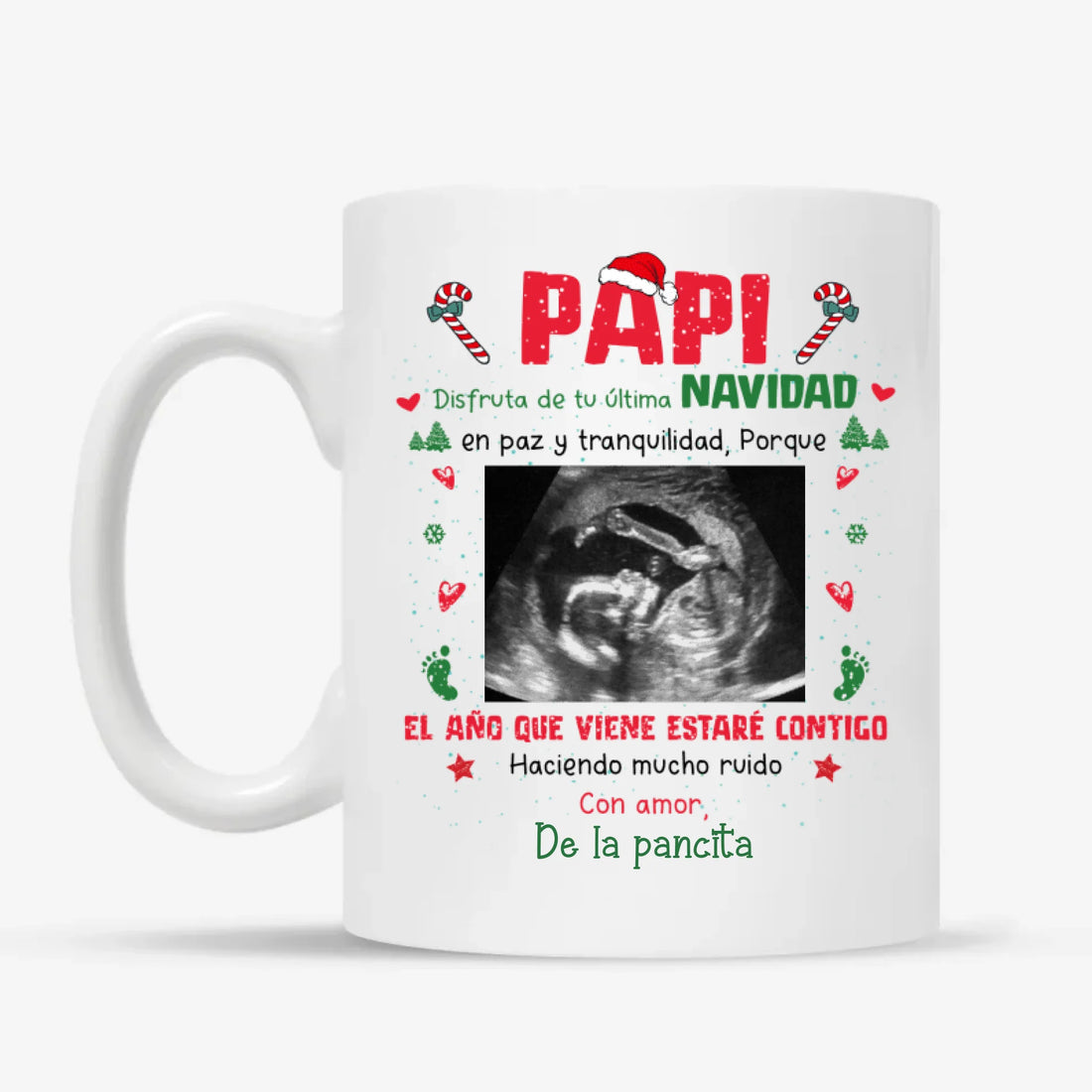 MUG Xám 2