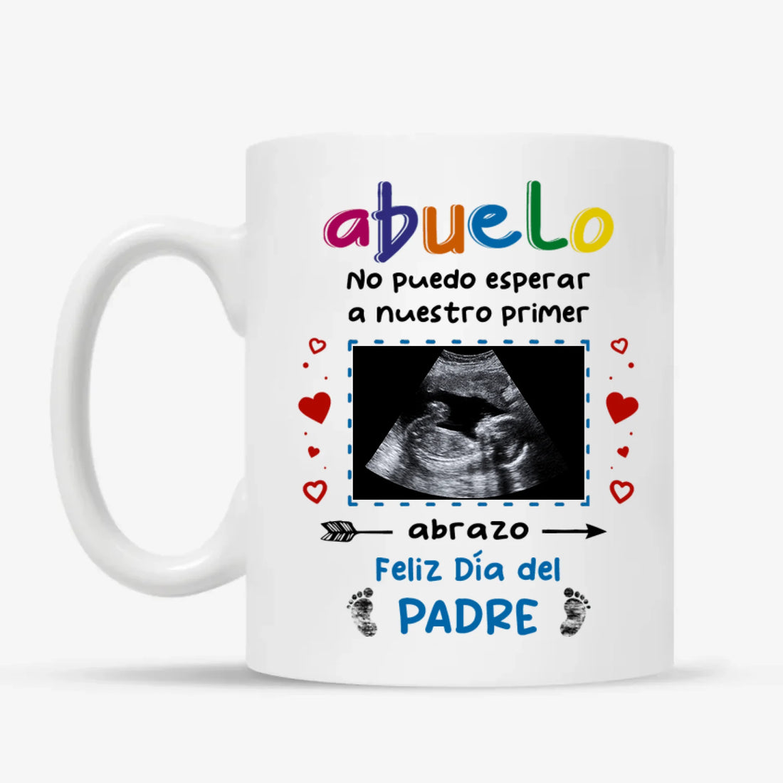 MUG Xám 2
