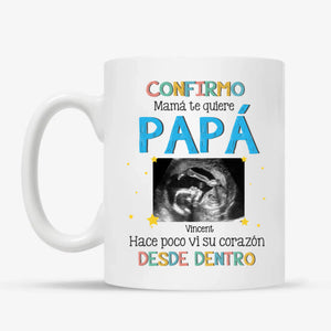 MUG Xám 2